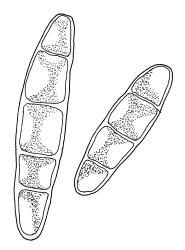 Sauloma tenella, gemmae. Drawn from A.J. Fife 6754, CHR 405820.
 Image: R.C. Wagstaff © Landcare Research 2017 
